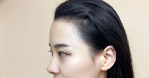 女性额头宽大发际线高面相好不好？