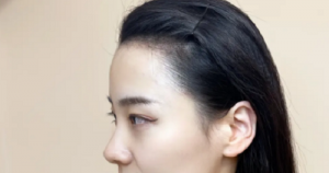 女性额头宽大发际线高面相好不好？