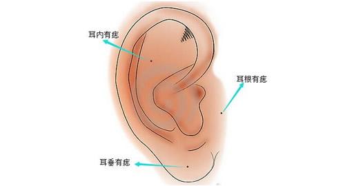 耳朵有痣图解对照表