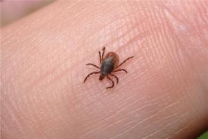 梦见头上长虱子并掐死是什么意思