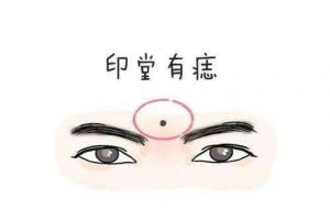 印堂有痣的男人代表什么意思