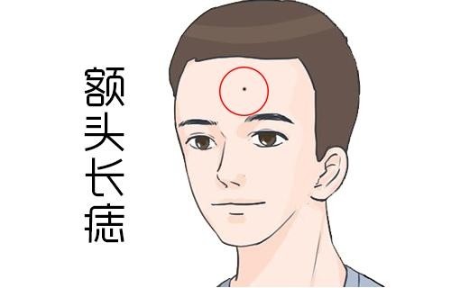 额头有痣的男人有什么寓意