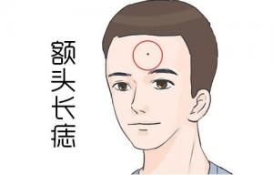 额头有痣的男人有什么寓意