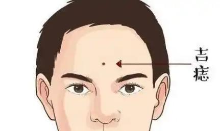 男人脸上哪里长痣最有福气? 男人脸上哪里长痣最有福气?